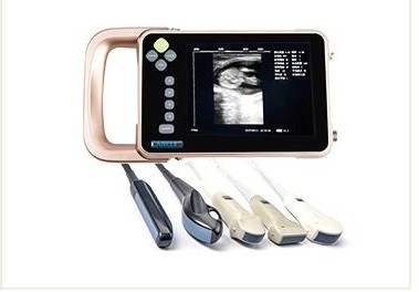 Ultrasound scanner